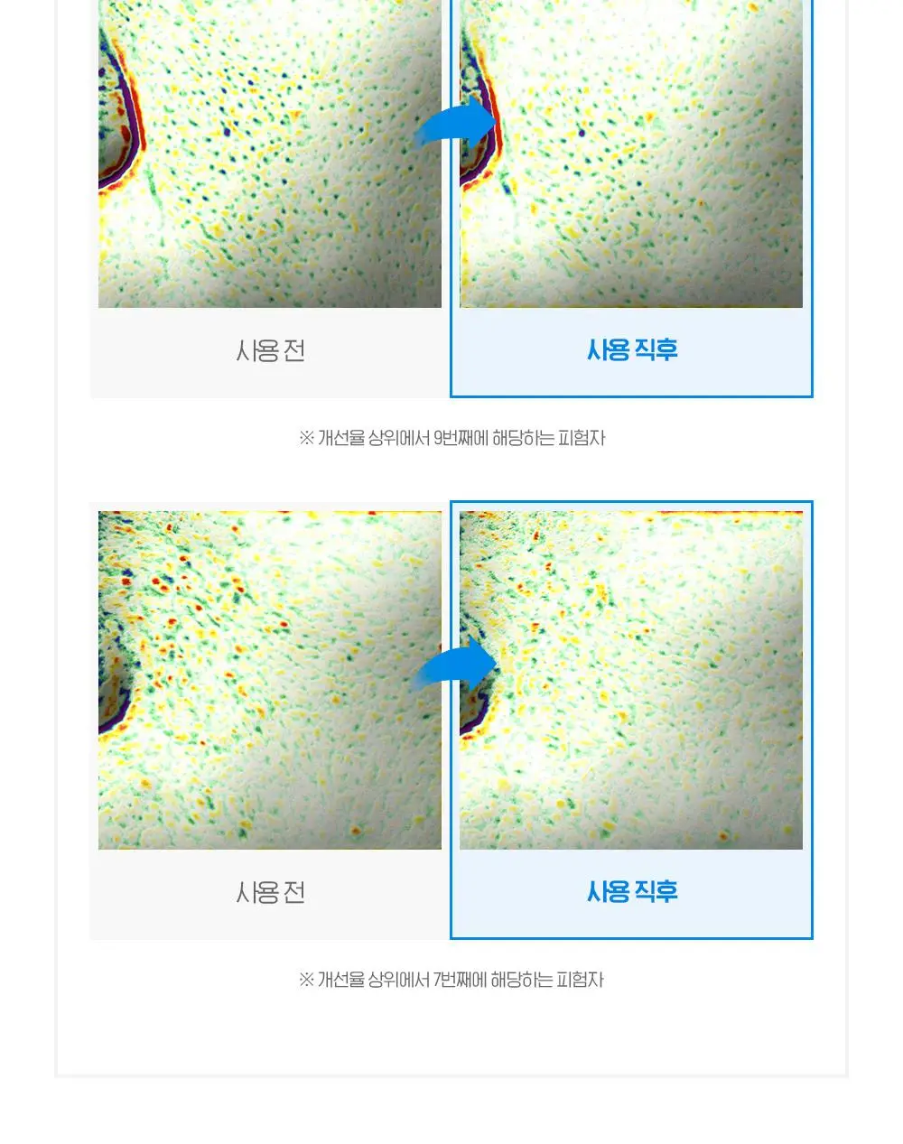 [쿨링결광토너] 빌리프 아쿠아 밤 프로즌 토너 300ml 기획 (+토너 50ml, 크림 9ml 증정) 상세페이지 19